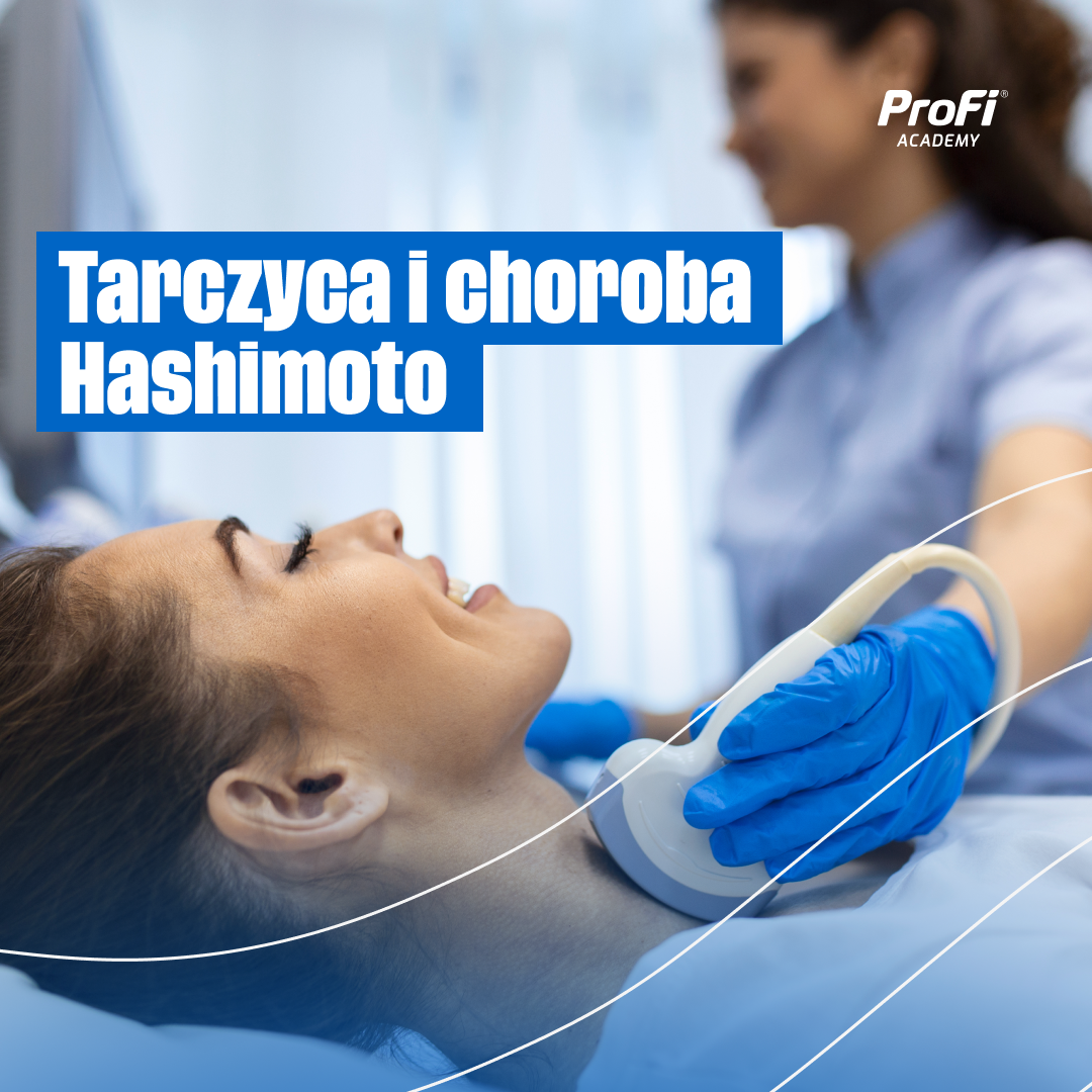 Tarczyca i choroba Hashimoto