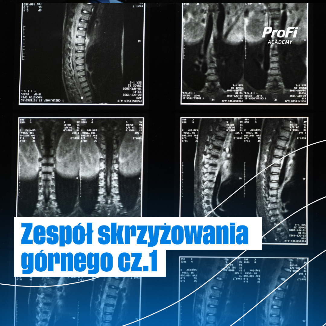 Zespół skrzyżowania górnego cz.1