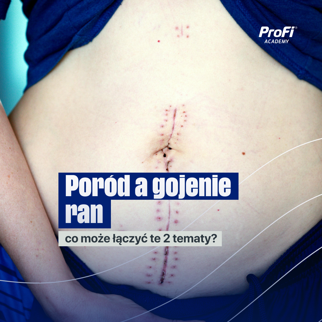 Poród a gojenie ran - co może łączyć te 2 tematy?