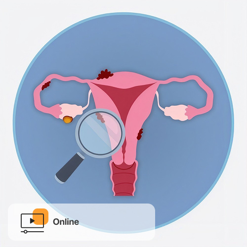 Endometrioza i PMOS