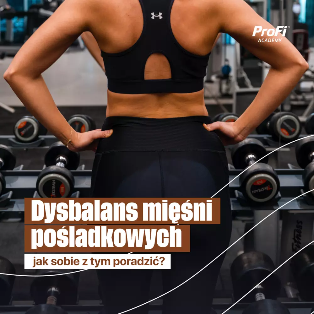 Dysbalans mięśni pośladkowych - jak sobie z tym poradzić?